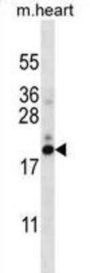Prefoldin Subunit 5 (PFDN5) Antibody