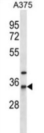 Arylamine N-Acetyltransferase 1 (NAT1) Antibody