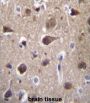 Melanocortin 2 Receptor Accessory Protein 2 (MRAP2) Antibody
