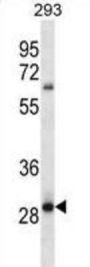 Melanocortin 2 Receptor Accessory Protein 2 (MRAP2) Antibody