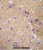 ABCC12 Antibody