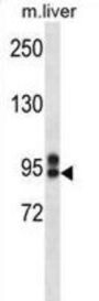 ABCC12 Antibody