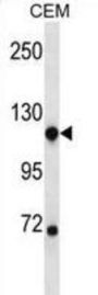 Bifunctional Heparan Sulfate N-Deacetylase/N-Sulfotransferase 1 (NDST1) Antibody