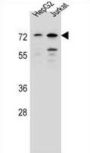 Dachshund Homolog 2 (DACH2) Antibody