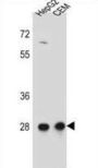 Coiled-Coil Domain Containing 134 (CCDC134) Antibody