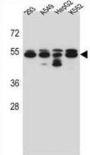 Tubulin Beta-8 Chain (TUBB8) Antibody