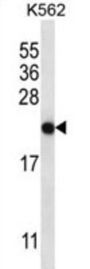 Glutathione-Specific Gamma-Glutamylcyclotransferase 2 (CHAC2) Antibody