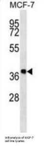 Dehydrogenase/Reductase SDR Family Member 7B (DHRS7B) Antibody