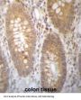Dehydrogenase/Reductase SDR Family Member 7B (DHRS7B) Antibody