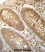 Probable Phosphoglycerate Mutase 4 (PGAM4) Antibody