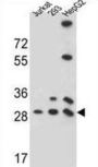 Probable Phosphoglycerate Mutase 4 (PGAM4) Antibody