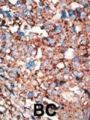 Heat Shock Protein 40 (HSP40) Antibody