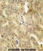 Heat Shock Protein 40 (HSP40) Antibody