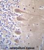 Zinc Finger Protein 764 (ZNF764) Antibody