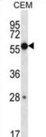Zinc Finger Protein 764 (ZNF764) Antibody