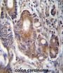 Ras-Related Protein Rab-21 (RAB21) Antibody