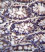 Tetratricopeptide Repeat Protein 15 (TTC15) Antibody