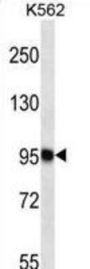 Tetratricopeptide Repeat Protein 15 (TTC15) Antibody