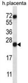 Ribonuclease A8 (RNASE8) Antibody