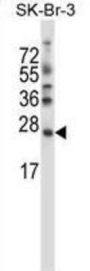Stromal Cell Derived Factor 2 Like Protein 1 (SDF2L1) Antibody