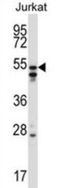 Heterogeneous Nuclear Ribonucleoprotein H2 (HNRNPH2) Antibody