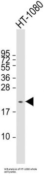 Cancer/Testis Antigen 1A (CTAG1A) Antibody