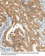 Cancer/Testis Antigen 1A (CTAG1A) Antibody
