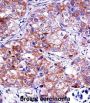 Inosine-5'-Monophosphate Dehydrogenase 1 (IMPDH1) Antibody