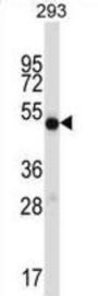 Inosine-5'-Monophosphate Dehydrogenase 1 (IMPDH1) Antibody