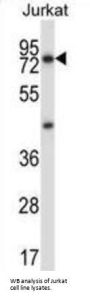 MCOLN1 Antibody