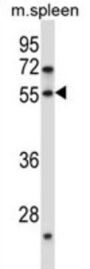 Protein Dok-7 (DOK7) Antibody