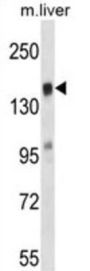 T-Lymphoma Invasion And Metastasis-Inducing Protein 2 (TIAM2) Antibody