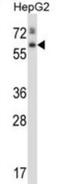 60 kDa Lysophospholipase (ASPG) Antibody