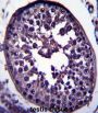 G Antigen 12H (GAGE12H) Antibody