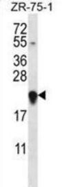 G Antigen 12H (GAGE12H) Antibody