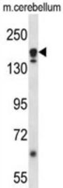 Autophagy-Related Protein 2 Homolog A (ATG2A) Antibody