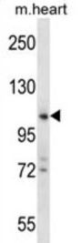Zinc Finger CCHC Domain-Containing Protein 14 (ZCCHC14) Antibody