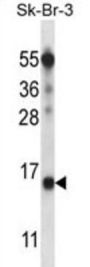 Transcription Factor BTF3 Homolog 4 (BTF3L4) Antibody