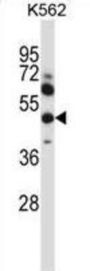 Matrix Metalloproteinase 13 (MMP13) Antibody