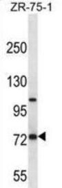Glutamate Carboxypeptidase 2 (FOLH1) Antibody
