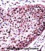 Splicing Factor 3b Subunit 1 (SF3B1) Antibody