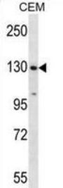 Splicing Factor 3b Subunit 1 (SF3B1) Antibody