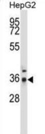 PPP4C Antibody
