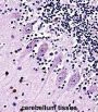 TRPC5 Antibody