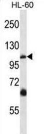 TRPC5 Antibody