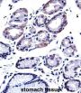 GTPase Activating Protein (SH3 Domain) Binding Protein 1 (G3BP1) Antibody