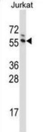 GTPase Activating Protein (SH3 Domain) Binding Protein 1 (G3BP1) Antibody