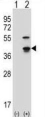 Cyclin-Dependent Kinase 3 (CDK3) Antibody