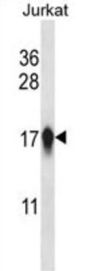 Centromere Protein A (CENPA) Antibody