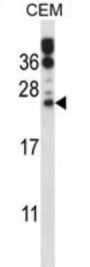 Ras-Related Protein Rab-6B (RAB6B) Antibody